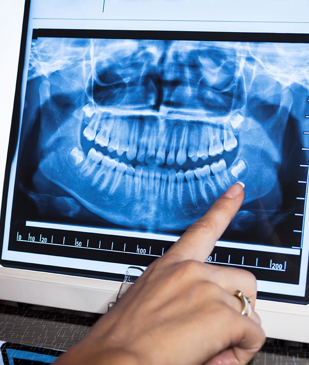 Person pointing to a dental X ray